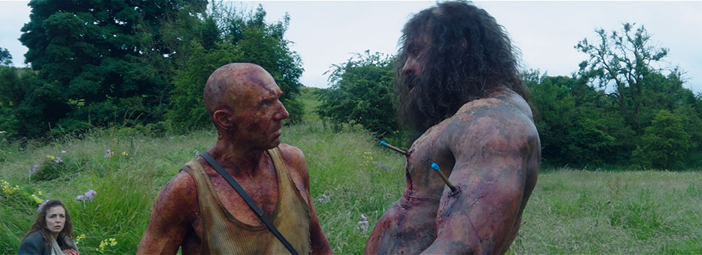Prosthetic arrows were digitally extended.