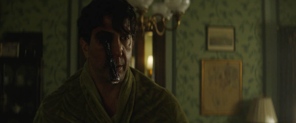 A forceful sneeze results in a dangling eye.