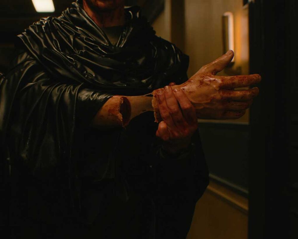 A severed hand is reattached using prosthetics, digitally augmented with dripping blood and stretching ligaments.