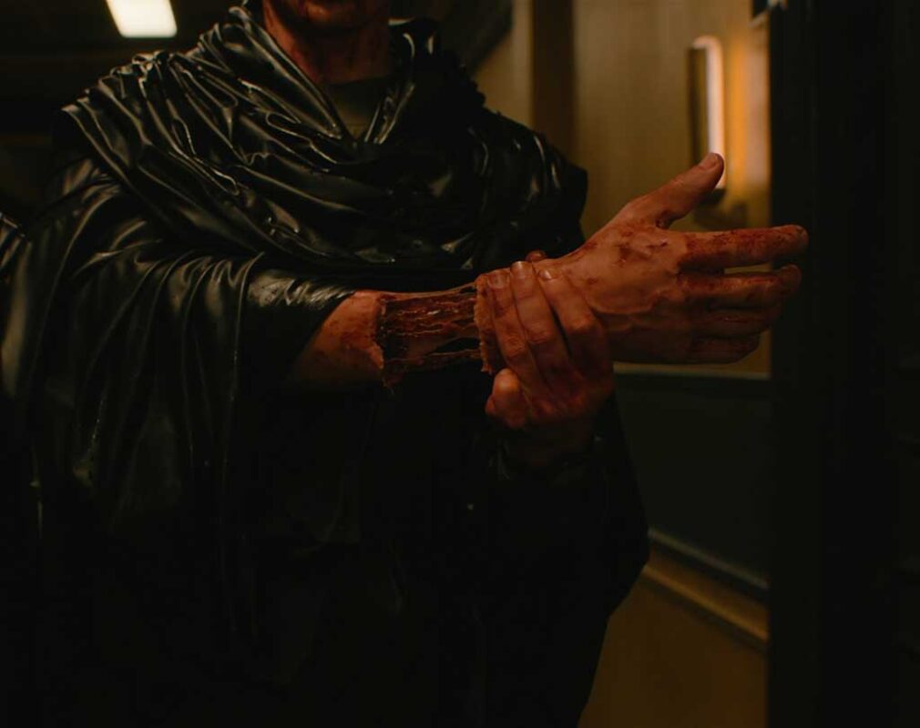 A severed hand is reattached using prosthetics, digitally augmented with dripping blood and stretching ligaments.